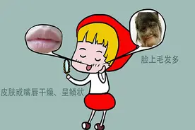 为什么有的女性嘴唇上会长小胡子？长小胡子的女性，有啥不同？图片