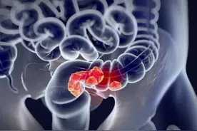 十几天没排便，却还不想上厕所？原本要拉的大便去哪了，告诉你图片