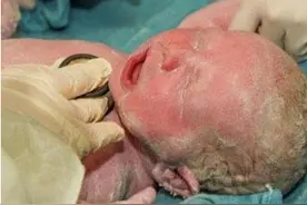 “白色宝宝”火了，刚出生全身白色吓哭父母，医生却说：恭喜图片