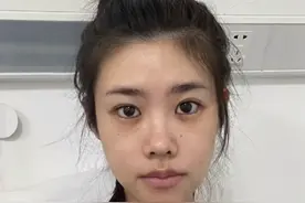 25岁千万粉网红患上卵巢癌！手术切除一侧附件，肿瘤破碎子宫出血图片