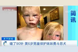 现实版的“超级英雄”！为保护4岁妹妹不受恶犬袭击 他被缝了90针图片