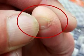 小脚趾甲裂成两瓣的人，到底是什么来历？是纯种汉族人？图片