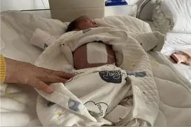 胎儿肚皮“开裂”，刚出生就经历3小时大手术图片