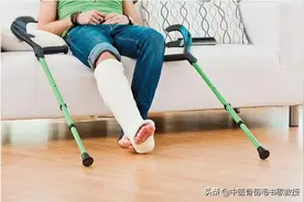 骨折愈合要多久？专家：满足这5点，骨折才算愈合图片