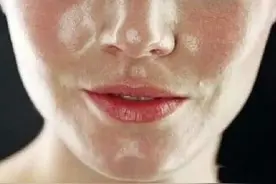 和油光暗沉脸说拜拜，用植物医生高山奇迹水就够了图片