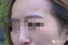 美女种假睫毛，眼皮粘连！店员：胶水有502的味道……图片