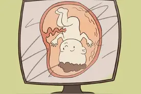 身体健康丨据说肚子尖生男，圆生女？真的？