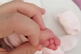 四维彩超显示有“双手”  婴儿出生无右臂 院方：确实漏诊了，愿承担相应责任视频封面