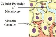 【科普】为什么有人晒不黑？皮肤科医生还原晒黑全过程图片