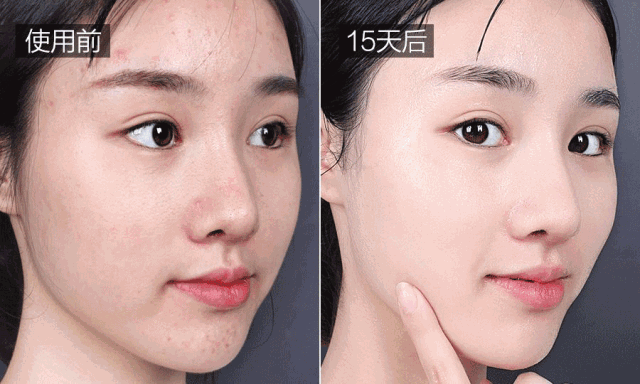 长期吃胶原蛋白有什么副作用 2026年长期吃胶原蛋白有什么副作用和危害