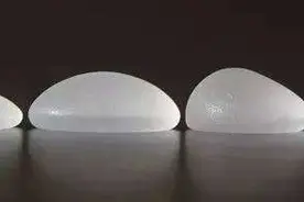假体丰胸如何控制假体的分布？隆胸价格是多少？图片