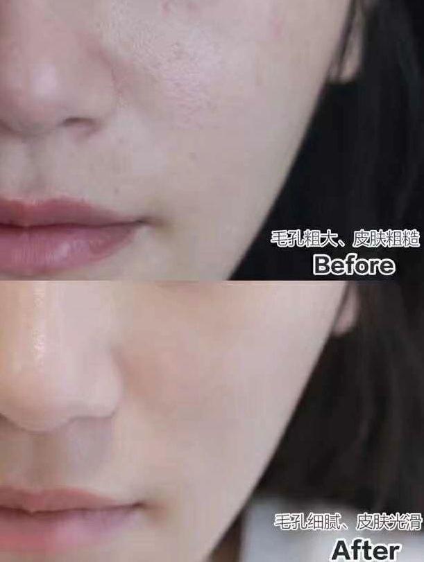 剖腹产吃花胶 增生 2026年剖腹产吃花胶 增生有用吗