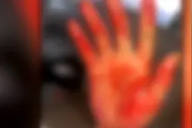 警惕！肇庆男子边充电边玩手机致爆炸，全身15%面积严重烧伤视频封面