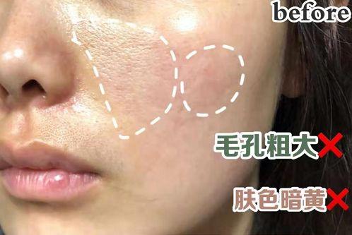 长期吃胶原蛋白有什么副作用 2026年长期吃胶原蛋白有什么副作用和危害