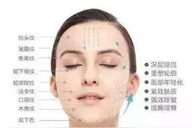 80后90后眼里，线雕究竟是怎样的一个项目？图片