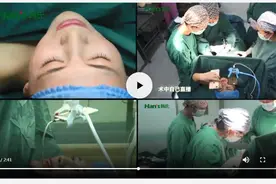 浅谈假体隆胸手术常见后遗症的表现及预防图片