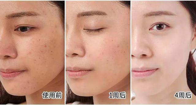 长期吃胶原蛋白有什么副作用 2026年长期吃胶原蛋白有什么副作用和危害