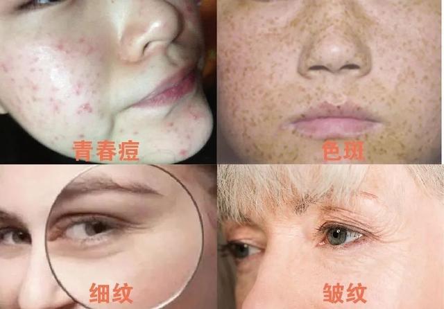 天天喝胶原蛋白对身体有害吗 2026年天天喝胶原蛋白的好处