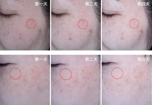 长期吃胶原蛋白有什么副作用 2026年长期吃胶原蛋白有什么副作用和危害