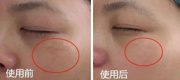 天天喝胶原蛋白对身体有害吗 2026年天天喝胶原蛋白的好处