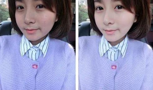 经常喝胶原蛋白有什么副作用 2026年经常喝胶原蛋白有什么副作用和危害