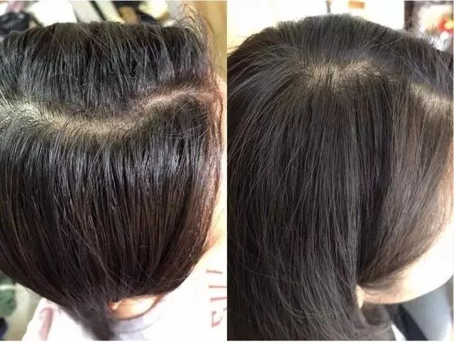 长期吃胶原蛋白有什么副作用 2026年长期吃胶原蛋白有什么副作用和危害