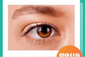 结膜出血后，冷敷热敷有讲究图片