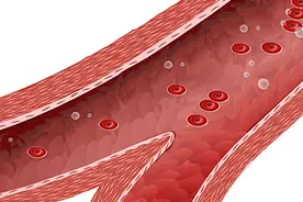 警惕！腿上出现这几种现象，相当于“不定时炸弹”！严重可致器官衰竭……图片