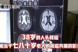 38岁男子被查出“痴呆晚期”，罪魁祸首意想不到...图片