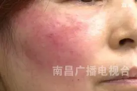 南昌女子花9000元美容！结果让她后悔不已……图片