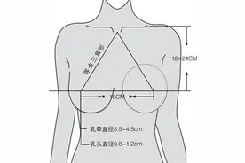 假体品牌如何选择可避免包膜挛缩等后遗症？图片