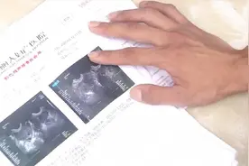 岳阳女子做人流手术，麻醉50分钟后医生突然中止手术，家属称血都没验人就推进手术室图片