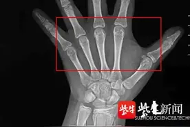 花季少女身高停滞不长 这个问题家长都需要重视图片