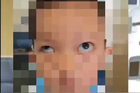 可怕！6岁男孩模仿短视频特效抠出眼球，犹如金鱼眼鼓出图片