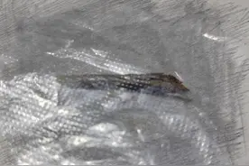 一碗排骨面让长沙69岁爷爷肠壁穿孔，医生提醒：进食时速度不宜过快图片