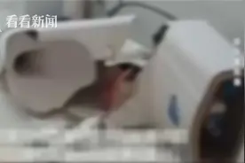 女子正上厕所，马桶突然爆裂……伤口缝了20多针图片