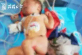 新生女婴遭遗弃耳朵爬满蛆虫 护士心疼哭了……图片