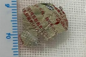 吸入南瓜子，吞进药品袋，两枚异物“卡住”一岁半小儿的呼吸图片