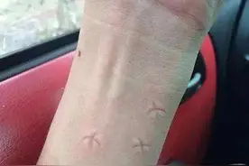 蚊子为什么就宠你？图片