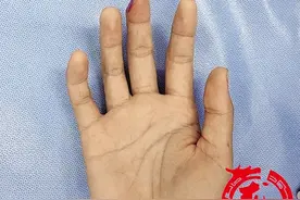 女子操作机器不慎手指被切掉松子大一截图片
