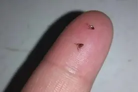 半月前飞来一种小黑虫，全楼居民都挨咬，有人一天被叮30多个包，到底哪来的？图片