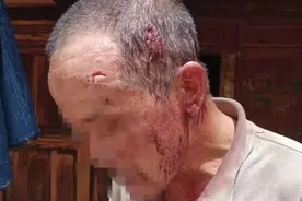 云南丽江一老人上山捡菌碰到黑熊，吓懵滚下百米山坡受伤图片