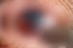 保温杯泡红枣10多天拧开爆炸怎么回事？为什么会爆炸？图片