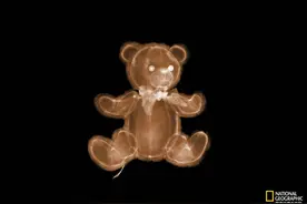 他不止用X射线拍尸体图片