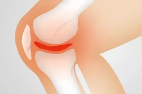 骨科科普 | 骨关节炎的预防措施有哪些？图片