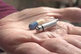 患者们的福音来了！金山这家医院率先开展“胶囊起搏器”植入手术图片