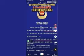 网红拉姆遭前夫纵火重度烧伤怎么回事 网红拉姆是谁被烧伤后现状如何图片