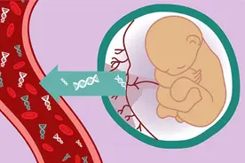 无创产检为何再获大奖？图片