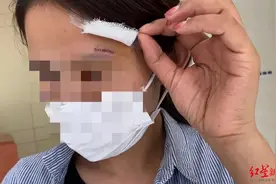 女子撞上透明玻璃门受伤缝了9针，物业自称没责任 听律师咋说图片