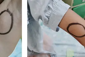 9岁女童“撸猫”后得怪病！这些症状千万别忽视图片